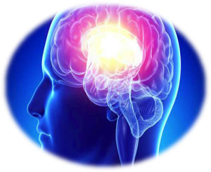 Neuroradiología e Intervencionismo neroradiologia